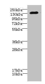 Western blot | All lanes: CACNA2D2 antibody IgG at 4.51μg/ml + Mouse brain tissue | Secondary | Goat polyclonal to rabbit IgG at 1/10000 dilution | Predicted band size: 130, 123, 131 kDa | Observed band size: 130 kDa