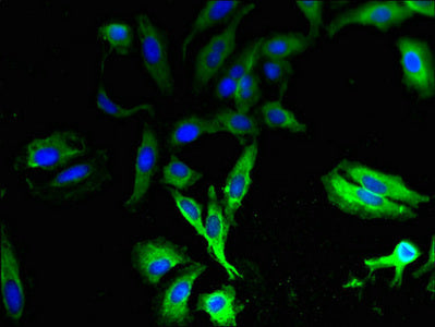 Immunofluorescent analysis of Hela cells using the antibody at dilution of 1:100 and Alexa Fluor 488-congugated AffiniPure Goat Anti-Rabbit IgG(H+L)Rabbit anti-Human TAS2R13 Polyclonal Antibody