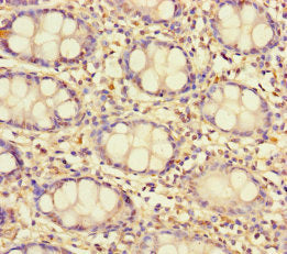 Immunohistochemistry of paraffin-embedded human colon tissue using TAS2R13 Antibody at dilution of 1:100Rabbit anti-Human TAS2R13 Polyclonal Antibody