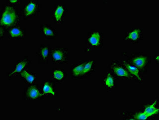 Immunofluorescent analysis of U251 cells using USE1 Antibody at dilution of 1:100 and Alexa Fluor 488-congugated AffiniPure Goat Anti-Rabbit IgG(H+L)Rabbit anti-Human USE1 Polyclonal Antibody