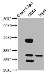 Immunoprecipitating USE1 in PC-3 whole cell lysate  | Lane 1: Rabbit control IgG (1μg) instead of USE1 Antibody in PC-3 whole cell lysate. | For western blotting, a HRP-conjugated Protein G antibody was used as the secondary antibody (1/2000) | Lane 2: USE1 Antibody (6μg) + PC-3 whole cell lysate (500μg) | Lane 3: PC-3 whole cell lysate (10μg)Rabbit anti-Human USE1 Polyclonal Antibody