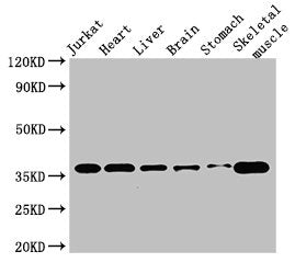 Western Blot | Positive WB detected in: Jurkat whole cell lysate, Mouse heart tissue, Mouse brain tissue, Mouse kidney tissue, Mouse stomach tissue, Mouse skeletal muscle tissue | All lanes: USE1 antibody at 2.8μg/ml | Secondary | Goat polyclonal to rabbit IgG at 1/50000 dilution | Predicted band size: 30, 17, 16 kDa | Observed band size: 36 kDaRabbit anti-Human USE1 Polyclonal Antibody