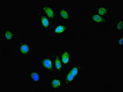Immunofluorescent analysis of A549 cells using SPG21 Antibody at dilution of 1:100 and Alexa Fluor 488-congugated AffiniPure Goat Anti-Rabbit IgG(H+L)Rabbit anti-Human SPG21 Polyclonal Antibody