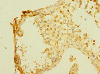 Immunohistochemistry of paraffin-embedded human testis tissue using MPP6 Antibody at dilution of 1:100Rabbit anti-Human MPP6 Polyclonal Antibody