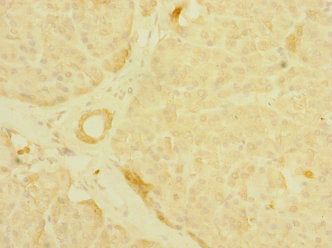 Immunohistochemistry of paraffin-embedded human pancreatic tissue using MPP6 Antibody at dilution of 1:100Rabbit anti-Human MPP6 Polyclonal Antibody