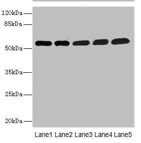 Western blot | All lanes: MPP6 antibody at 3.58μg/ml | Lane 1: Mouse brain tissue | Lane 2: Mouse kidney tissue | Lane 3: HepG2 whole cell lysate | Lane 4: Hela whole cell lysate | Lane 5: A549 whole cell lysate | Secondary | Goat polyclonal to rabbit IgG at 1/10000 dilution | Predicted band size: 61 kDa | Observed band size: 61 kDa