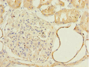 Immunohistochemistry of paraffin-embedded human kidney tissue using NDUFA13 Antibody at dilution of 1:100Rabbit anti-Human NDUFA13 Polyclonal Antibody