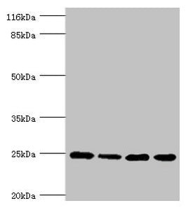 Western blot | All lanes: NDUFA13 antibody at 3.97μg/ml | Lane 1: 293T whole cell lysate | Lane 2: Hela whole cell lysate | Lane 3: Jurkat whole cell lysate | Lane 4: MCF-7 whole cell lysate | Secondary | Goat polyclonal to rabbit IgG at 1/10000 dilution | Predicted band size: 17, 25 kDa | Observed band size: 25 kDaRabbit anti-Human NDUFA13 Polyclonal Antibody