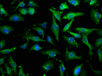 Immunofluorescence staining of U251 cells with MDFIC Antibody at 1:100, counter-stained with DAPI. The cells were fixed in 4% formaldehyde, permeabilized using 0.2% Triton X-100 and blocked in 10% normal Goat Serum. The cells were then incubated with the antibody overnight at 4°C. The secondary antibody was Alexa Fluor 488-congugated AffiniPure Goat Anti-Rabbit IgG(H+L).