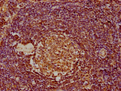 IHC image of MDFIC Antibody diluted at 1:300 and staining in paraffin-embedded human lymph node tissue performed on a Leica BondTM system. After dewaxing and hydration, antigen retrieval was mediated by high pressure in a citrate buffer (pH 6.0). Section was blocked with 10% normal goat serum 30min at RT. Then primary antibody (1% BSA) was incubated at 4°C overnight. The primary is detected by a biotinylated secondary antibody and visualized using an HRP conjugated SP system.