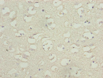Immunohistochemistry of paraffin-embedded human brain tissue using TBC1D14 Antibody at dilution of 1:100Rabbit anti-Human TBC1D14 Polyclonal Antibody
