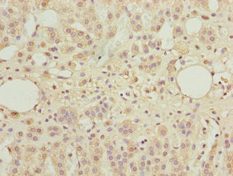 Immunohistochemistry of paraffin-embedded human adrenal gland tissue using TBC1D14 Antibody at dilution of 1:100Rabbit anti-Human TBC1D14 Polyclonal Antibody