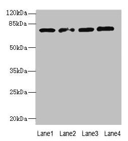 Western blot | All lanes: TBC1D14 antibody at 4μg/ml | Lane 1: K562 whole cell lysate | Lane 2: U87 whole cell lysate | Lane 3: A549 whole cell lysate | Lane 4: HepG2 whole cell lysate | Secondary | Goat polyclonal to rabbit IgG at 1/10000 dilution | Predicted band size: 79, 48 kDa | Observed band size: 79 kDaRabbit anti-Human TBC1D14 Polyclonal Antibody