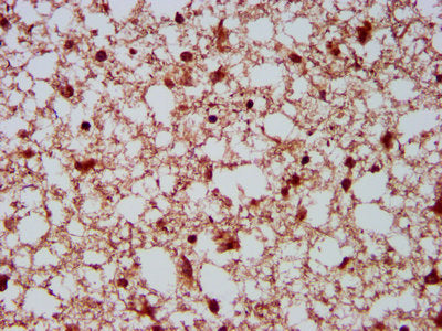 IHC image of HECW2 Antibody diluted at 1:500 and staining in paraffin-embedded human brain tissue performed on a Leica BondTM system. After dewaxing and hydration, antigen retrieval was mediated by high pressure in a citrate buffer (pH 6.0). Section was blocked with 10% normal goat serum 30min at RT. Then primary antibody (1% BSA) was incubated at 4°C overnight. The primary is detected by a biotinylated secondary antibody and visualized using an HRP conjugated SP system.Rabbit anti-Human HECW2 Polyclonal Antibody