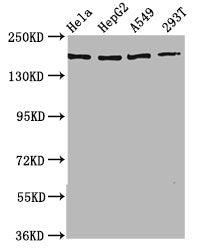 Western Blot | Positive WB detected in: Hela whole cell lysate, HepG2 whole cell lysate, A549 whole cell lysate, 293T whole cell lysate | All lanes: HECW2 antibody at 3.5μg/ml | Secondary | Goat polyclonal to rabbit IgG at 1/50000 dilution | Predicted band size: 176, 136 kDa | Observed band size: 176 kDaRabbit anti-Human HECW2 Polyclonal Antibody