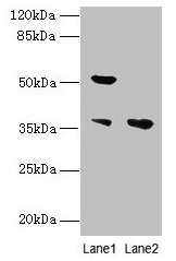 Western blot  | All lanes: IMPACT antibody at 10µg/ml  | Lane 1: Hela whole cell lysate  | Lane 2: HL60 whole cell lysate  | Secondary  | Goat polyclonal to rabbit IgG at 1/10000 dilution  | Predicted band size: 37, 23 kDa  | Observed band size: 37, 52 kDaRabbit anti-Human IMPACT Polyclonal Antibody
