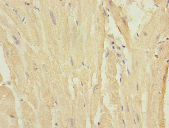 Immunohistochemistry of paraffin-embedded human heart tissue using MYL7 Antibody at dilution of 1:100Rabbit anti-Human MYL7 Polyclonal Antibody