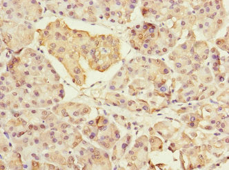 Immunohistochemistry of paraffin-embedded human pancreatic tissue using MYL7 Antibody at dilution of 1:100Rabbit anti-Human MYL7 Polyclonal Antibody