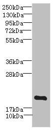 Western blot | All lanes: MYL7 antibody IgG at 2.69μg/ml + Mouse skeletal muscle tissue | Secondary | Goat polyclonal to rabbit IgG at 1/10000 dilution | Predicted band size: 19 kDa | Observed band size: 19 kDaRabbit anti-Human MYL7 Polyclonal Antibody