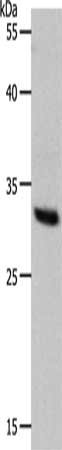 Gel: 10%SDS-PAGE, Lysate: 40 μg, Lane: Hela cells, Primary antibody: NQO1 Antibody(NQO1 Antibody) at dilution 1/1000, Secondary antibody: Goat anti rabbit IgG at 1/8000 dilution, Exposure time: 30 secondsRabbit anti-Human NQO1 Polyclonal Antibody