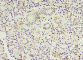 Immunohistochemistry of paraffin-embedded human pancreatic tissue using MTRR Antibody at dilution of 1:100Rabbit anti-Human MTRR Polyclonal Antibody