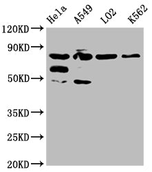 Western Blot | Positive WB detected in: Hela whole cell lysate, A549 whole cell lysate, L02 whole cell lysate, K562 whole cell lysate | All lanes: MTRR antibody at 1:2000 | Secondary | Goat polyclonal to rabbit IgG at 1/50000 dilution | Predicted band size: 81, 78, 7 kDa | Observed band size: 81 kDaRabbit anti-Human MTRR Polyclonal Antibody