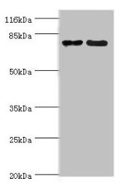 Western blot | All lanes: MTRR antibody at 2μg/ml | Lane 1: PC-3 whole cell lysate | Lane 2: HepG2 whole cell lysate | Secondary | Goat polyclonal to rabbit IgG at 1/10000 dilution | Predicted band size: 81, 78, 7 kDa | Observed band size: 81 kDaRabbit anti-Human MTRR Polyclonal Antibody