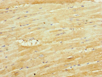 Immunohistochemistry of paraffin-embedded human heart tissue using UQCR10 Antibody at dilution of 1:100Rabbit anti-Human UQCR10 Polyclonal Antibody