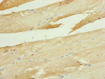 Immunohistochemistry of paraffin-embedded human skeletal muscle tissue using UQCR10 Antibody at dilution of 1:100Rabbit anti-Human UQCR10 Polyclonal Antibody