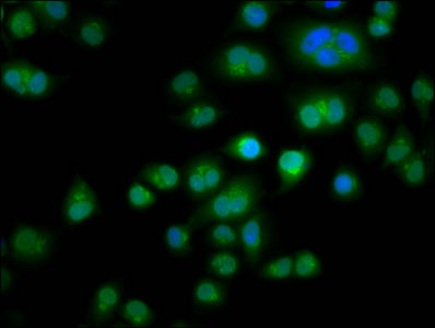 Immunofluorescence staining of Hela cells with TES Antibody at 1:266, counter-stained with DAPI. The cells were fixed in 4% formaldehyde, permeabilized using 0.2% Triton X-100 and blocked in 10% normal Goat Serum. The cells were then incubated with the antibody overnight at 4°C. The secondary antibody was Alexa Fluor 488-congugated AffiniPure Goat Anti-Rabbit IgG(H+L).Rabbit anti-Human TES Polyclonal Antibody