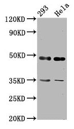 Western Blot  | Positive WB detected in: 293 whole cell lysate, Hela whole cell lysate  | All lanes: TES antibody at 2.92µg/ml  | Secondary  | Goat polyclonal to rabbit IgG at 1/50000 dilution  | Predicted band size: 48, 47 kDa  | Observed band size: 48 kDaRabbit anti-Human TES Polyclonal Antibody