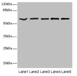 Western blot  | All lanes: ASIC3 antibody at 2.4µg/ml  | Lane 1: Jurkat whole cell lysate  | Lane 2: HepG2 whole cell lysate  | Lane 3: Hela whole cell lysate  | Lane 4: A549 whole cell lysate  | Lane 5: A431 whole cell lysate  | Secondary  | Goat polyclonal to rabbit IgG at 1/10000 dilution  | Predicted band size: 59, 61, 45 kDa  | Observed band size: 59 kDa