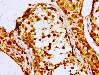 Immunohistochemistry of paraffin-embedded human testis tissue using NPC1 Antibody at dilution of 1:100Rabbit anti-Human NPC1 Polyclonal Antibody