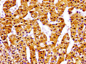 Immunohistochemistry of paraffin-embedded human adrenal gland tissue using NPC1 Antibody at dilution of 1:100Rabbit anti-Human NPC1 Polyclonal Antibody