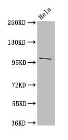 Western Blot  | Positive WB detected in: Hela whole cell lysate  | All lanes: NPC1 antibody at 3µg/ml  | Secondary  | Goat polyclonal to rabbit IgG at 1/50000 dilution  | Predicted band size: 143, 108 kDa  | Observed band size: 108 kDaRabbit anti-Human NPC1 Polyclonal Antibody