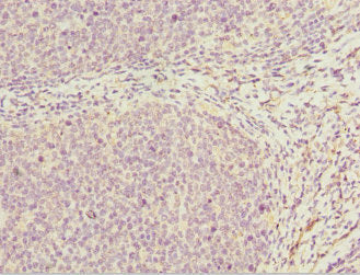 Immunohistochemistry of paraffin-embedded human tonsil tissue using DDX20 Antibody at dilution of 1:100Rabbit anti-Human DDX20 Polyclonal Antibody