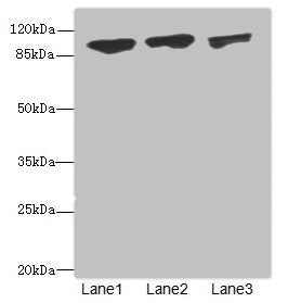 Western blot | All lanes: DDX20antibody at 1.91μg/ml | Lane 1: 293T whole cell lysate | Lane 2: HepG2 whole cell lysate | Lane 3: Hela whole cell lysate | Secondary | Goat polyclonal to rabbit IgG at 1/10000 dilution | Predicted band size: 93, 15 kDa | Observed band size: 93 kDaRabbit anti-Human DDX20 Polyclonal Antibody