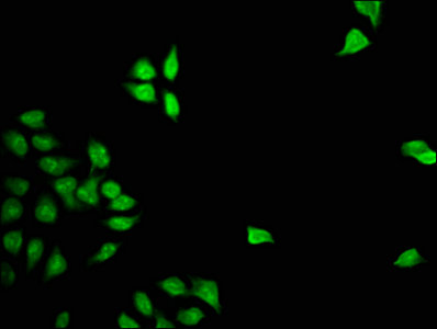 Immunofluorescence staining of Hela cells with FOXD3 Antibody at 1:133, counter-stained with DAPI. The cells were fixed in 4% formaldehyde, permeabilized using 0.2% Triton X-100 and blocked in 10% normal Goat Serum. The cells were then incubated with the antibody overnight at 4°C. The secondary antibody was Alexa Fluor 488-congugated AffiniPure Goat Anti-Rabbit IgG(H+L).Rabbit anti-Human FOXD3 Polyclonal Antibody