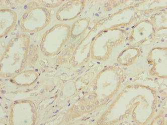 Immunohistochemistry of paraffin-embedded human kidney tissue using the antibody at dilution of 1:100Rabbit anti-Human PILRB Polyclonal Antibody