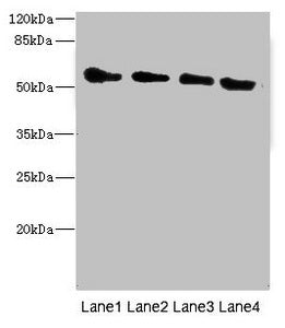 Western blot | All lanes: TRHDE antibody at 1.77μg/ml | Lane 1: Rat heart tissue | Lane 2: Mouse kidney tissue | Lane 3: 293T whole cell lysate | Lane 4: HepG2 whole cell lysate | Secondary | Goat polyclonal to rabbit IgG at 1/10000 dilution | Predicted band size: 117 kDa | Observed band size: 117 kDa