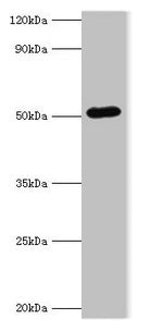Western blot  | All lanes: BAG5 antibody at 1µg/ml + A549 whole cell lysate  | Secondary  | Goat polyclonal to rabbit IgG at 1/10000 dilution  | Predicted band size: 52, 57 kDa  | Observed band size: 52 kDa