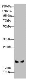 Western blot  | All lanes: BLOC1S6 antibody at 3.13µg/ml + A431 whole cell lysate  | Secondary  | Goat polyclonal to rabbit IgG at 1/10000 dilution  | Predicted band size: 20, 9 kDa  | Observed band size: 20 kDa