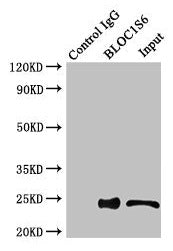 Immunoprecipitating BLOC1S6 in HEK293 whole cell lysate  | Lane 1: Rabbit control IgG instead of (1µg) instead of BLOC1S6 Antibody in HEK293 whole cell lysate. For western blotting, a HRP-conjugated anti-rabbit IgG, specific to the non-reduced form of IgG was used as the Secondary antibody (1/50000)  | Lane 2: BLOC1S6 Antibody (4µg) + HEK293 whole cell lysate (500µg)  | Lane 3: HEK293 whole cell lysate (20µg)