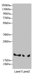 Western blot  | All lanes: BLOC1S6 antibody at 3.33µg/ml  | Lane 1: A431 whole cell lysate  | Lane 2: 293T whole cell lysate  | Secondary  | Goat polyclonal to rabbit IgG at 1/10000 dilution  | Predicted band size: 20, 9 kDa  | Observed band size: 20 kDa