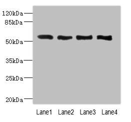 Western blot | All lanes: VANGL2 antibody at 2.26μg/ml | Lane 1: HepG2 whole cell lysate | Lane 2: MCF-7 whole cell lysate | Lane 3: Hela whole cell lysate | Lane 4: NIH/3T3 whole cell lysate | Secondary | Goat polyclonal to rabbit IgG at 1/10000 dilution | Predicted band size: 60 kDa | Observed band size: 60 kDaRabbit anti-Human VANGL2 Polyclonal Antibody