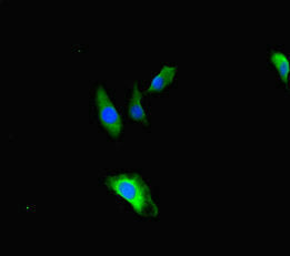 Immunofluorescent analysis of Hela cells using TBC1D24 Antibody at dilution of 1:100 and Alexa Fluor 488-congugated AffiniPure Goat Anti-Rabbit IgG(H+L)Rabbit anti-Human TBC1D24 Polyclonal Antibody