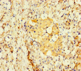 Immunohistochemistry of paraffin-embedded human pancreatic tissue using TBC1D24 Antibody at dilution of 1:100Rabbit anti-Human TBC1D24 Polyclonal Antibody