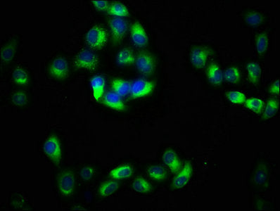 Immunofluorescence staining of Hela cells with PACSIN2 Antibody at 1:133, counter-stained with DAPI. The cells were fixed in 4% formaldehyde, permeabilized using 0.2% Triton X-100 and blocked in 10% normal Goat Serum. The cells were then incubated with the antibody overnight at 4°C. The secondary antibody was Alexa Fluor 488-congugated AffiniPure Goat Anti-Rabbit IgG(H+L).Rabbit anti-Human PACSIN2 Polyclonal Antibody