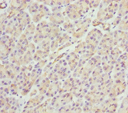 Immunohistochemistry of paraffin-embedded human pancreatic tissue using PACSIN2 Antibody at dilution of 1:100Rabbit anti-Human PACSIN2 Polyclonal Antibody