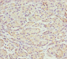 Immunohistochemistry of paraffin-embedded human pancreatic tissue using PACSIN2 Antibody at dilution of 1:100Rabbit anti-Human PACSIN2 Polyclonal Antibody